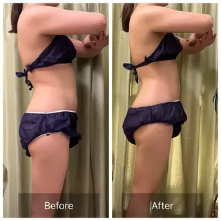 【元に戻らない】 小顔&部分痩せのその他イメージ