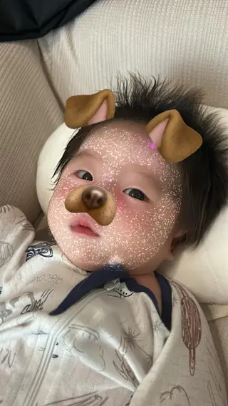 美容鍼灸Solana所属・肌質改善×美容鍼 ゆいのエステ・リラクイメージ