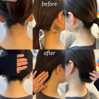 うなじ脱毛/美肌脱毛 LABELのエステ・リラクイメージ