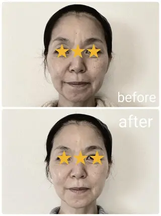  毛穴洗浄・まつ毛 の専門店 ソラーレのエステ・リラクイメージ