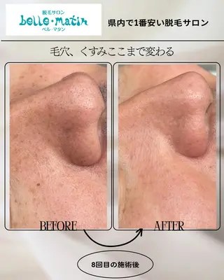脱毛サロン　　　ベル・マタン所属・脱毛サロン ベル・マタンのエステ・リラクイメージ