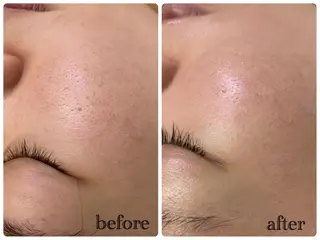 デ・アイム新潟北所属・サイトウ .のエステ・リラクイメージ