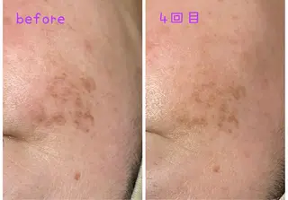 Sss所属・sera ＊のマツエク・マツパデザイン