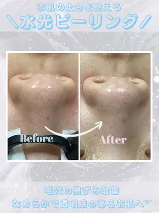 レイビス盛岡店 ♡吉田♡のエステ・リラクイメージ