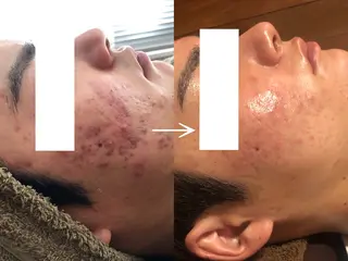 Beauty Max所属・Beauty Max 大石のエステ・リラクイメージ