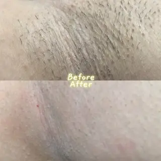 Hit. シュガーリング豊橋のエステ・リラクイメージ