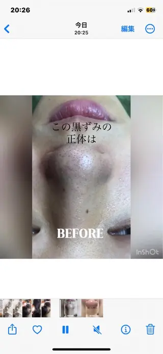 private salon  Dea_maris シュガーリング＆パーソナルボディケア所属・シミ改善・韓国肌管理 ボディメイク痩身のその他イメージ