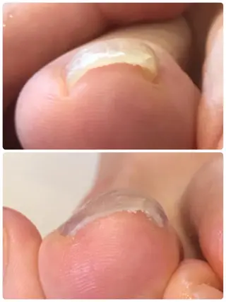 ネイル 冨澤 ひろみのネイルデザイン