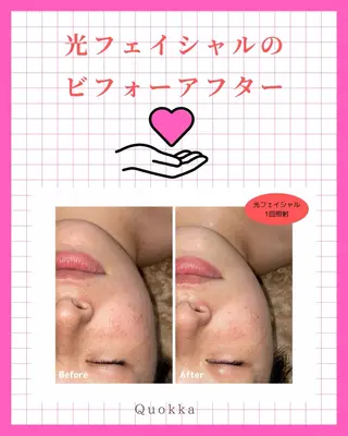 Quokka ✴︎ あま市甚目寺のエステ・リラクイメージ