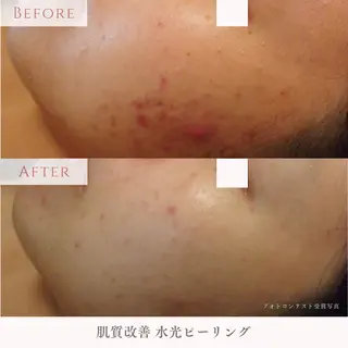 肌質改善サロン LesFleursのエステ・リラクイメージ