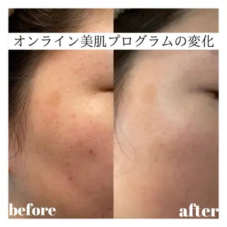 トータルビューティーサロンハルプラス所属・美肌・リラク ハルプラスのエステ・リラクイメージ