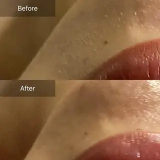 Mandarin Orange所属・毛穴から始める肌メン テマンダリンオレンジのエステ・リラクイメージ