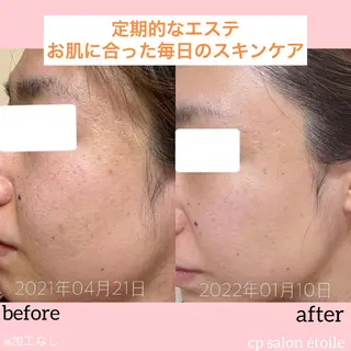 pansy(パンジー)上野フェイシャルエステ専門店所属・pansy saraのエステ・リラクイメージ