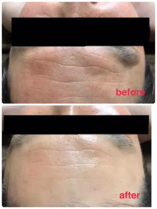 首・肩こり専門リンパ ケアサロンSENKAのエステ・リラクイメージ