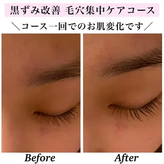 Bellesthe （ベルエステ）のエステ・リラクイメージ