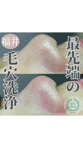 毛穴肌質ケアサロン Yourmeユアミーのエステ・リラクイメージ