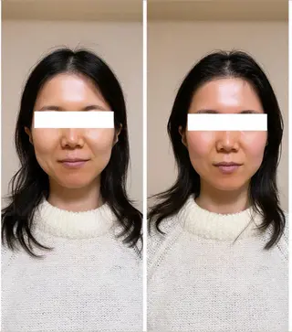 自律神経を整える フェイシャルエステのエステ・リラクイメージ