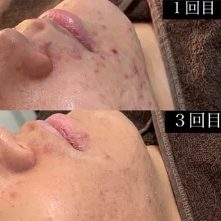 メンズ 韓国肌管理Belle静岡所属・Belle静岡 稲葉のエステ・リラクイメージ