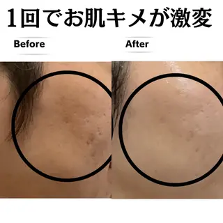 フェイシャルエステサロン 　グレースティー所属・毛穴・ニキビ専門 エステグレースティーのエステ・リラクイメージ