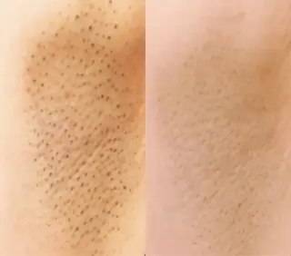 スターラッシュ薬院本店所属・スターラッシュ staffのエステ・リラクイメージ