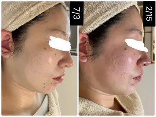 MELIA the beauty所属・肌のお悩み改善サロン MELIA/朋美のエステ・リラクイメージ