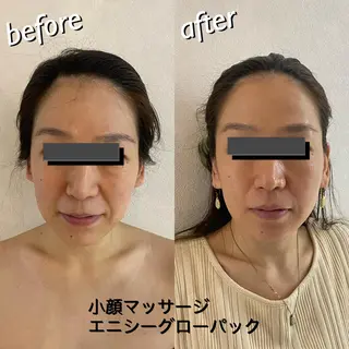 うなじ脱毛/美肌脱毛 LABELのエステ・リラクイメージ