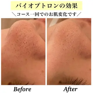 Bellesthe （ベルエステ）のエステ・リラクイメージ