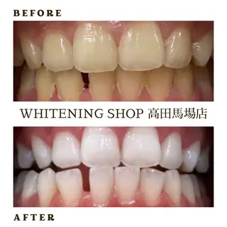 メンズ ホワイトニング ショップ高田馬場店のその他イメージ
