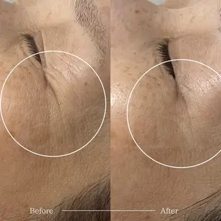 北浜/毛穴洗浄ツヤ肌 サロンaniRのエステ・リラクイメージ