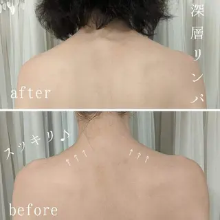 整体エステ　NEW ME所属・深層リンパオイル/小 顔とドライヘッドスパのエステ・リラクイメージ