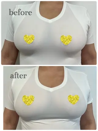 OWL TOTAL BEAUTY SALON所属・OWL 脱毛&バストケアのその他イメージ