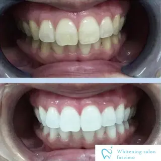 セルフホワイトニングサロンfascimo所属・ホワイトニングサロン fascimo新座店のその他イメージ