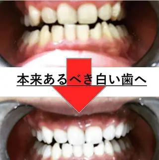 ホワイトニングサロン nico西葛西店のその他イメージ