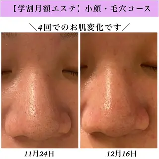 Bellesthe （ベルエステ）のエステ・リラクイメージ