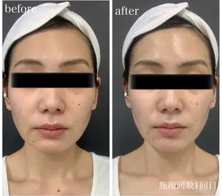 Genesis Plus大津京店のエステ・リラクイメージ