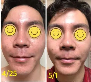 横浜ビューティーファクトリーHANA元町店所属・エステ＆アロマ HANAのエステ・リラクイメージ