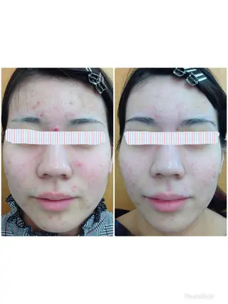 Facial stylist salon伊勢崎所属・中島 有希のエステ・リラクイメージ