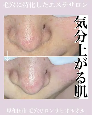毛穴汚れ改善専門店/ 岸和田/リヒオルオルのエステ・リラクイメージ