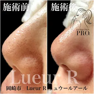 大久保 里奈のエステ・リラクイメージ