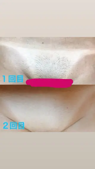 杉原 里奈のエステ・リラクイメージ