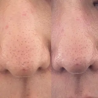 Meetite 小林のエステ・リラクイメージ