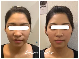 痩身・小顔・脱毛 グレイスボディのエステ・リラクイメージ