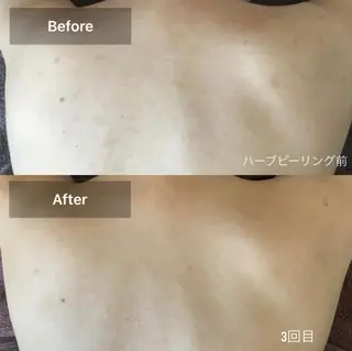 美肌・リラクゼーションサロンLu,Mie所属・美肌と癒しのサロン Lu,Mieのエステ・リラクイメージ