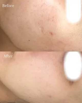 BELLIS HUIT所属・ハーブピーリング那覇 BELLISHUITのエステ・リラクイメージ