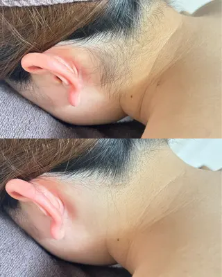 都度払い制脱毛サロンBe Charm所属・Be Charm 山﨑のエステ・リラクイメージ