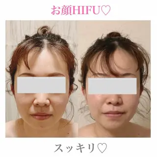 a room salonのエステ・リラクイメージ