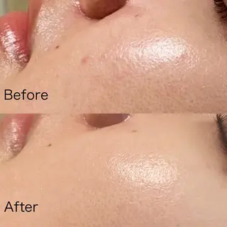 Ranan【ラナン】 keikoのエステ・リラクイメージ