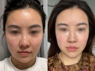 aliaハイフ&水光ジェットサロン所属・aliaハーブ水光店 エステティシャン募集のエステ・リラクイメージ