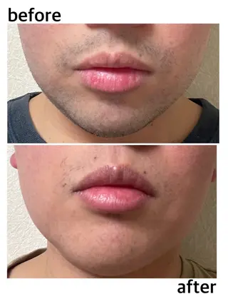 メンズ PROSOL こころのエステ・リラクイメージ