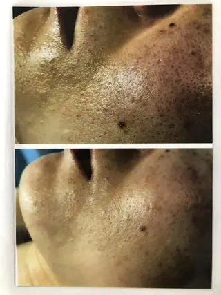 Dione湘南藤沢店 ×LUANA 齋藤のエステ・リラクイメージ